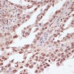 Phospho-ATF (Thr71) Antibody in Immunohistochemistry (Paraffin) (IHC (P))