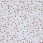 Phospho-ERK1 (Tyr204) Antibody in Immunohistochemistry (Paraffin) (IHC (P))