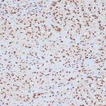 Phospho-ERK1 (Tyr204) Antibody in Immunohistochemistry (Paraffin) (IHC (P))