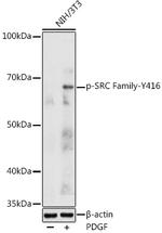 Phospho-SRC (Tyr416) Antibody in Western Blot (WB)