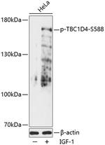 Phospho-AS160 (Ser588) Antibody in Western Blot (WB)