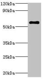 ATP6V1B2 Antibody in Western Blot (WB)