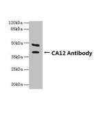 Carbonic Anhydrase XII Antibody in Western Blot (WB)