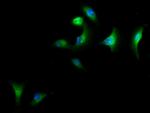 CAP1 Antibody in Immunocytochemistry (ICC/IF)