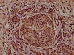 CAP1 Antibody in Immunohistochemistry (Paraffin) (IHC (P))