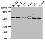 CAP1 Antibody in Western Blot (WB)