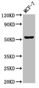 CHKA Antibody in Western Blot (WB)