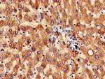 B4GALT3 Antibody in Immunohistochemistry (Paraffin) (IHC (P))