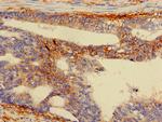 RPS5 Antibody in Immunohistochemistry (Paraffin) (IHC (P))