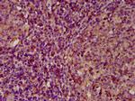 ECM1 Antibody in Immunohistochemistry (Paraffin) (IHC (P))