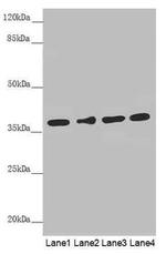 ERLIN2 Antibody in Western Blot (WB)