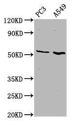 ETV5 Antibody in Western Blot (WB)