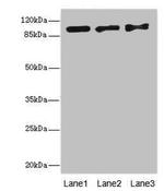 EXO1 Antibody in Western Blot (WB)