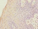 FOXP1 Antibody in Immunohistochemistry (Paraffin) (IHC (P))