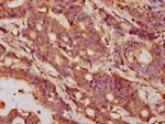 GDF5 Antibody in Immunohistochemistry (Paraffin) (IHC (P))