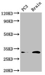 HOXD8 Antibody in Western Blot (WB)