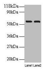 IMPDH2 Antibody in Western Blot (WB)