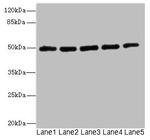 Kir2.3 (KCNJ4) Antibody in Western Blot (WB)