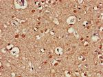 ATG13 Antibody in Immunohistochemistry (Paraffin) (IHC (P))