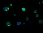 Cytokeratin 16 Antibody in Immunocytochemistry (ICC/IF)