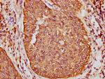 Cytokeratin 16 Antibody in Immunohistochemistry (Paraffin) (IHC (P))