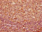 Cytokeratin 16 Antibody in Immunohistochemistry (Paraffin) (IHC (P))