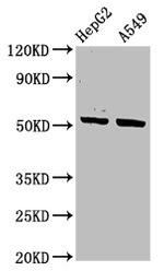 Cytokeratin 16 Antibody in Western Blot (WB)