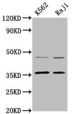 MAGEA2 Antibody in Western Blot (WB)