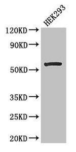 MCD Antibody in Western Blot (WB)