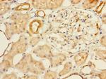 MTHFD2 Antibody in Immunohistochemistry (Paraffin) (IHC (P))