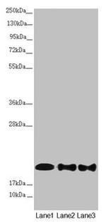 NDUFB10 Antibody in Western Blot (WB)