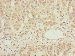 NDUFS6 Antibody in Immunohistochemistry (Paraffin) (IHC (P))