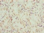 NDUFS6 Antibody in Immunohistochemistry (Paraffin) (IHC (P))