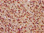 PARP3 Antibody in Immunohistochemistry (Paraffin) (IHC (P))