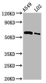 PARP3 Antibody in Western Blot (WB)