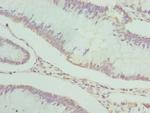 PDXK Antibody in Immunohistochemistry (Paraffin) (IHC (P))