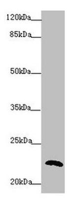 Cyclophilin F Antibody in Western Blot (WB)