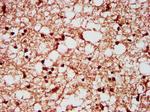 SF3B1 Antibody in Immunohistochemistry (Paraffin) (IHC (P))