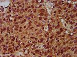 SF3B1 Antibody in Immunohistochemistry (Paraffin) (IHC (P))