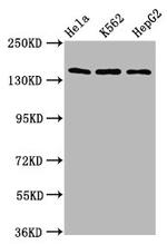 SF3B1 Antibody in Western Blot (WB)