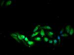 SOCS7 Antibody in Immunocytochemistry (ICC/IF)