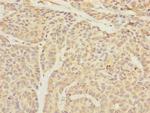 TIMM23 Antibody in Immunohistochemistry (Paraffin) (IHC (P))