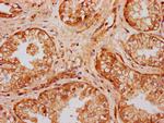 UMODL1 Antibody in Immunohistochemistry (Paraffin) (IHC (P))