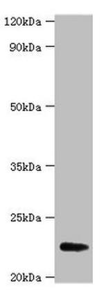 FGF21 Antibody in Western Blot (WB)