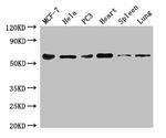 TROVE2 Antibody in Western Blot (WB)