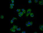 GNAS Antibody in Immunocytochemistry (ICC/IF)