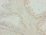 TBCE Antibody in Immunohistochemistry (Paraffin) (IHC (P))