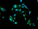 NFATC3 Antibody in Immunocytochemistry (ICC/IF)