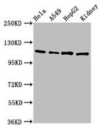 NFATC3 Antibody in Western Blot (WB)