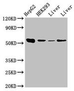 MEK5 Antibody in Western Blot (WB)